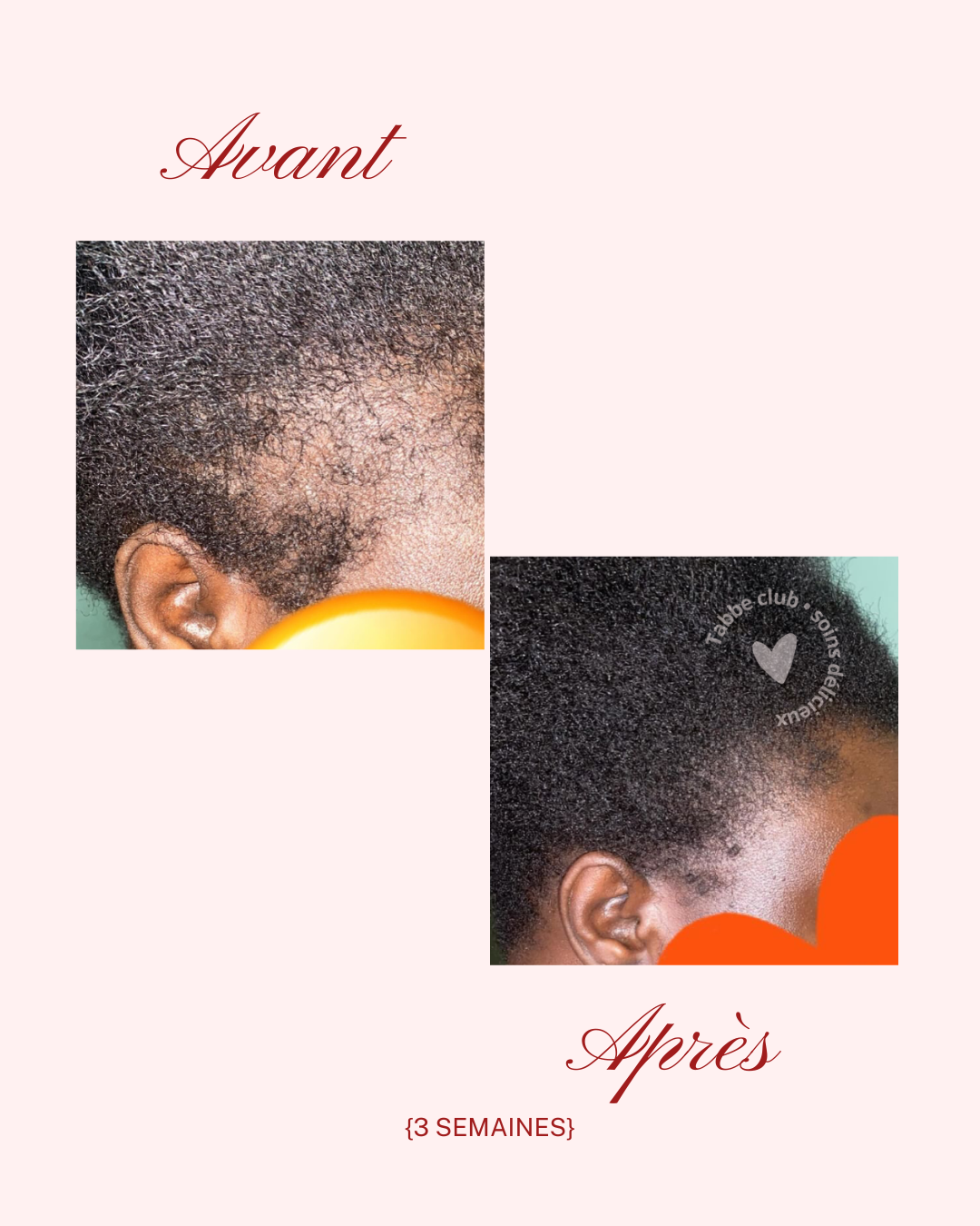 Generous drops : l’élixir généreux