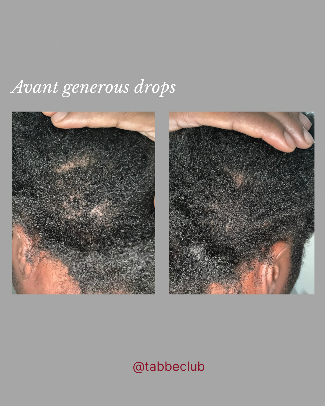 Generous drops : l’élixir généreux