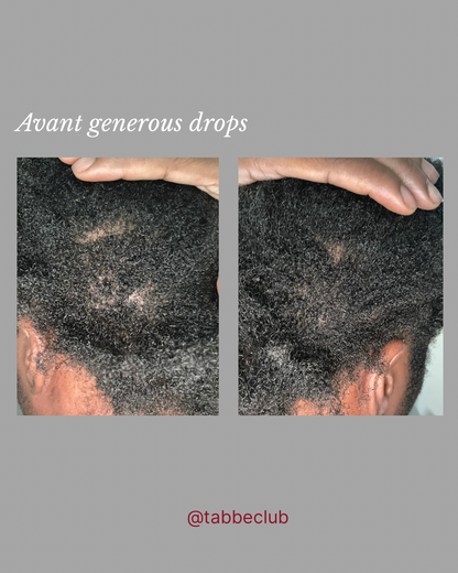 Generous drops : l’élixir généreux